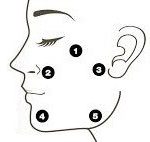 Profhilo 2 ProfHilo® Behandlung