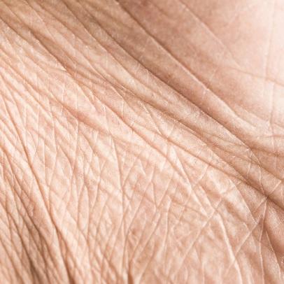 altersbedingt erschlaffte Haut1altersbedingt erschlaffte Haut behandlung