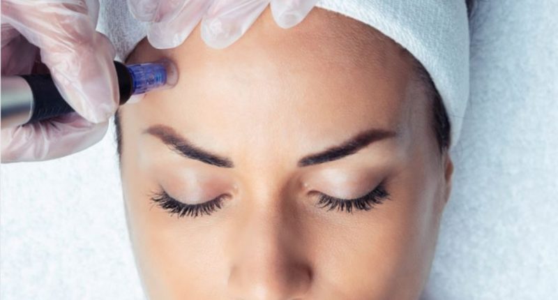 Medical Microneedling Rostock (Mikroneedling) microneedling